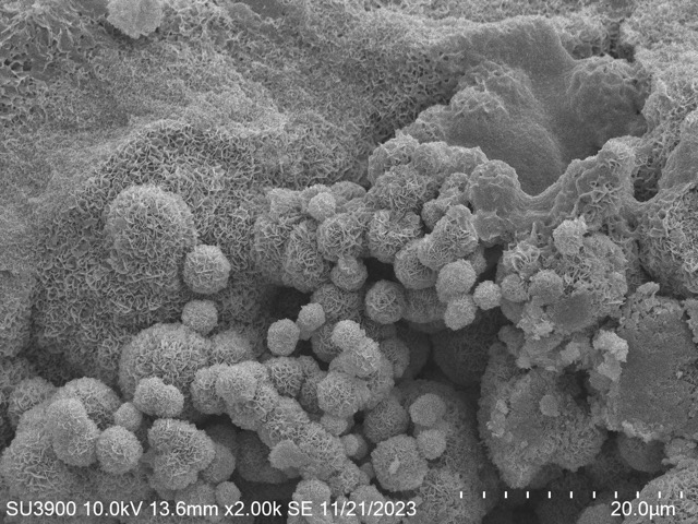 SEM image of mineral acretion on Bamboo